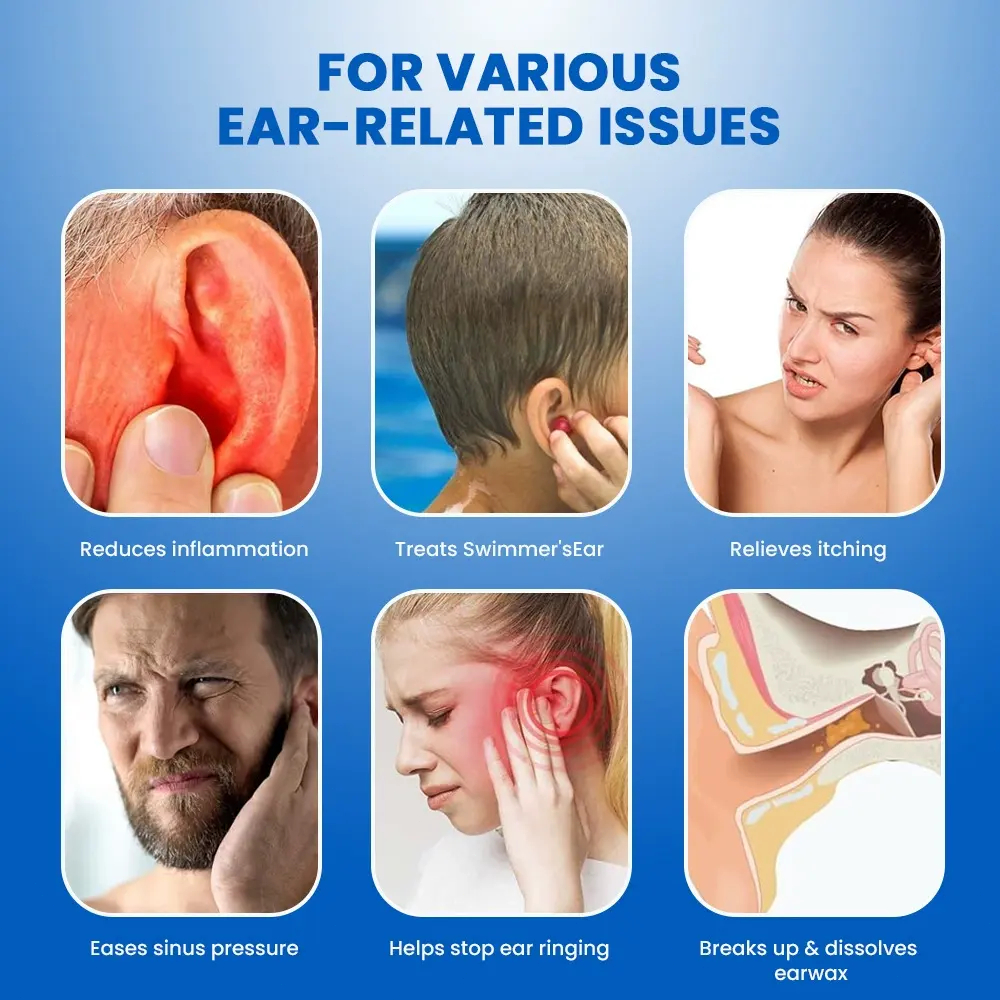 Jual Obat Congek Menahun 20ml Tinnitus Relief Ear Discomfort Perawatan ...