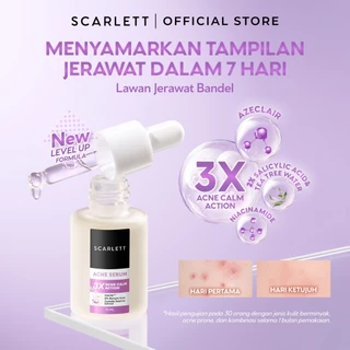 NEW FORMULA Scarlett Acne Serum Azeclair, 2% Salicylic Acid & Niacinamide - Serum Jerawat , Melawan Jerawat , Membantu Menyamarkan Tampilan Jerawat, Cocok Untuk Kulit Berjerawat