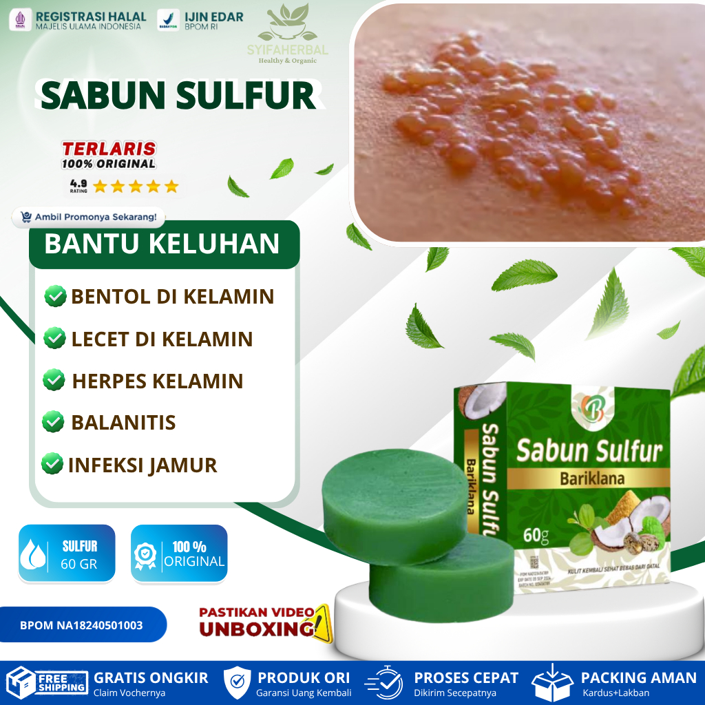 Jual SABUN SULFUR untuk luka lecet, bentol, bintik merah, dan ...