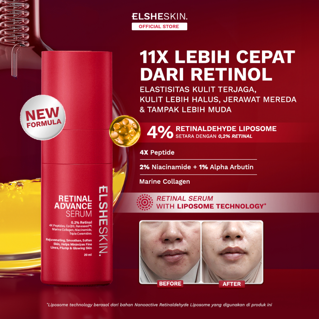 Elsheskin Retinal Advance Serum 20ml - Anti Aging Serum untuk Kulit Kenyal, Bebas Jerawat