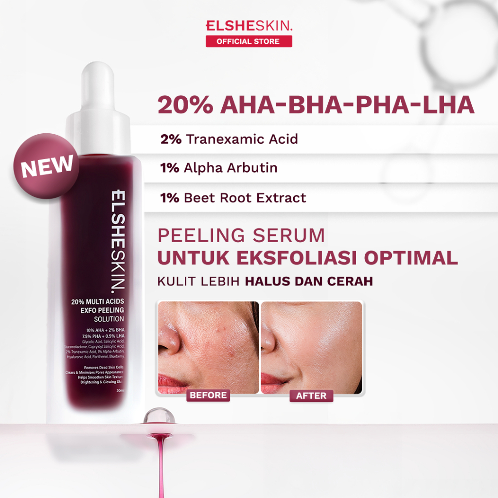 Elsheskin 20% Multi Acids Exfo Peeling Solution 35ml - Exfoliating Serum, Serum Eksfoliasi Wajah, Mengangkat Sel Kulit Mati, Brightening, Mencerahkan Kulit Kusam, Membersihkan Komedo, Pori, Menghaluskan Tekstur Kulit, Memudarkan Dark Spot