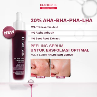 Elsheskin 20% Multi Acids Exfo Peeling Solution 35ml - Exfoliating Serum, Serum Eksfoliasi Wajah, Mengangkat Sel Kulit Mati, Brightening, Mencerahkan Kulit Kusam, Membersihkan Komedo, Pori, Menghaluskan Tekstur Kulit, Memudarkan Dark Spot