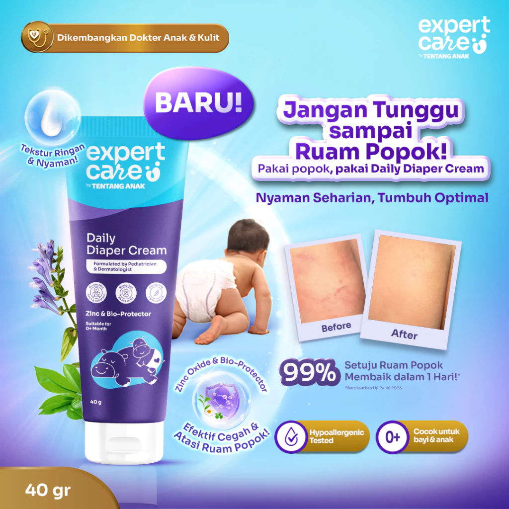 Jual Diaper Rash Cream | Expert Care Daily Diaper Cream 40 g | Redakan ...