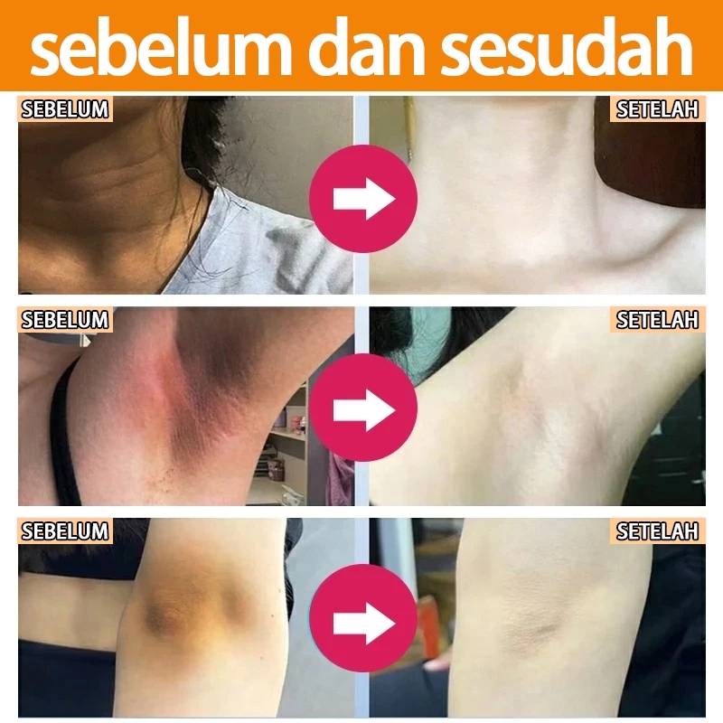 Product image Cream pemutih krim pemutih cream pemutih wajah glowing cepat cream pemutih wajah cream wajah pemutih paling cepat cream whitening crim malam pemutih wajah whitening cream whitening cream wajah whitening glowing cream crim malam pemutih wajah 2