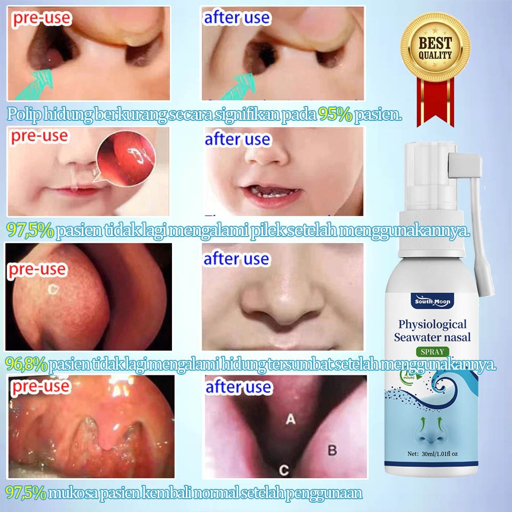 Jual MYSTICORE Obat sinusitis Nasal spray Rhinitis spray Sinusitis ...