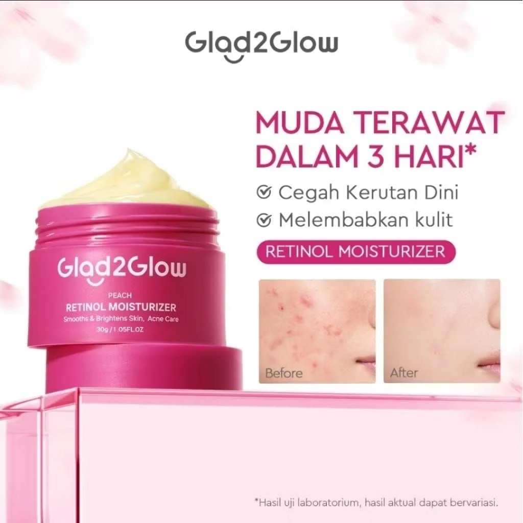 READY STOK G2G GLAD2GLOW FACEWASH /MOUISTURIZER/SERUM/ CENTELLA 55GRAM  PEACH RETINOL POMEGRANATE BLUEBERRY 30GRAM MOISTURIZER SMOTHS AND BRIGTENS SKIN ACNE CARE