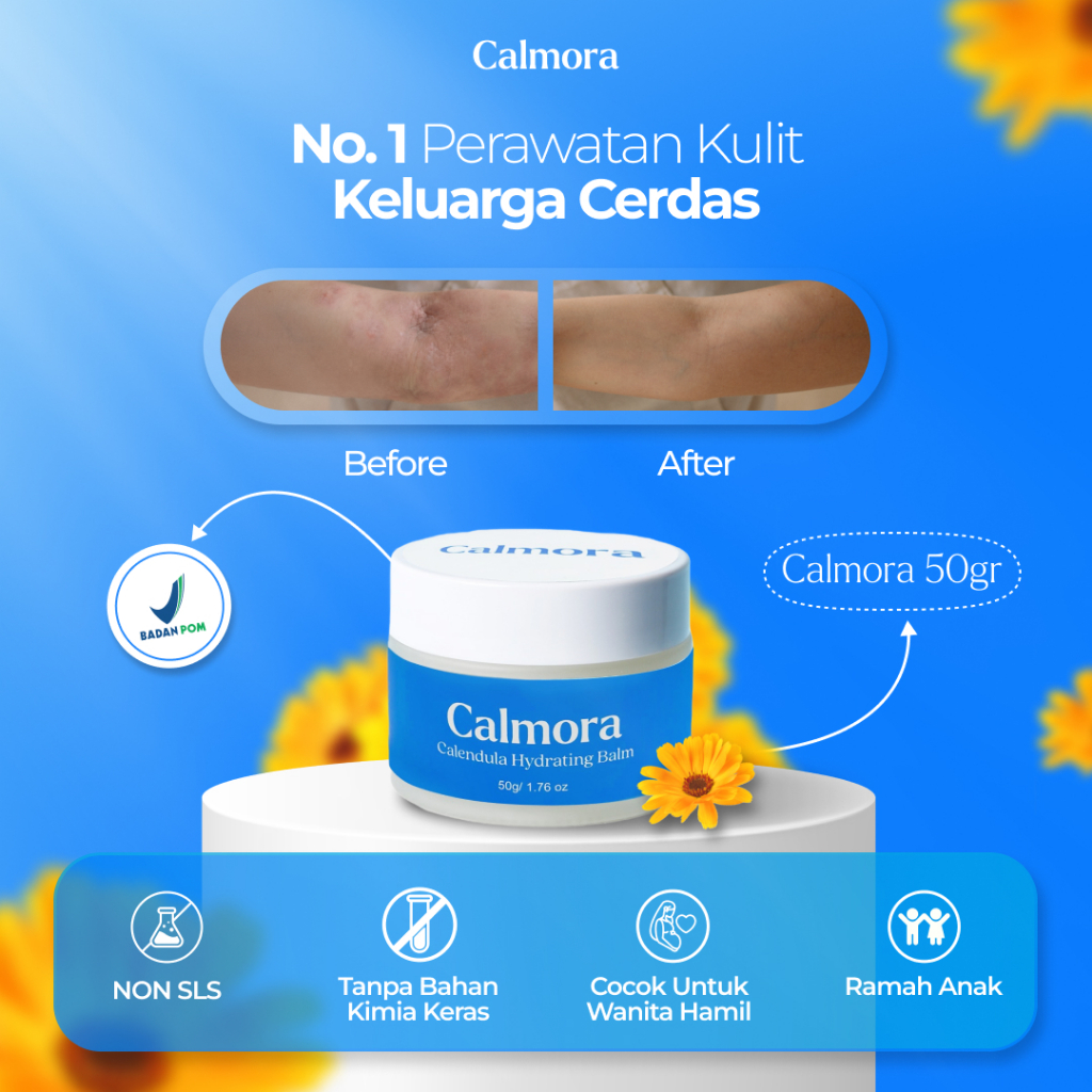 Jual Calmora Calendula Skin Savior Hydrating Balm Salve Untuk Eksim ...