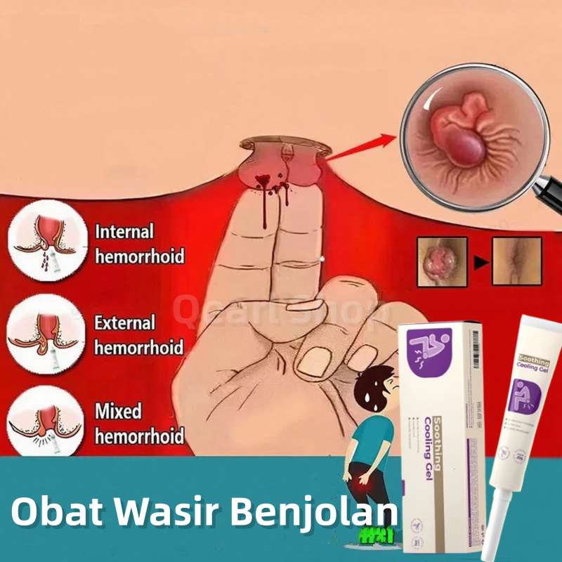 Obat Wasir Salep Wasir Original Obat Ambeyen Ambeicn Luar Salep Ambeien Paling Ampuh Menghilangkan Benjolan Meredakan Nyeri, Gatal & Peradangan Cepat Terserap Tidak Lengket