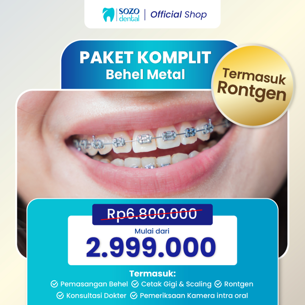 Jual Sozo Dental - Paket Behel Metal Basic Komplit (Dokter umum ...