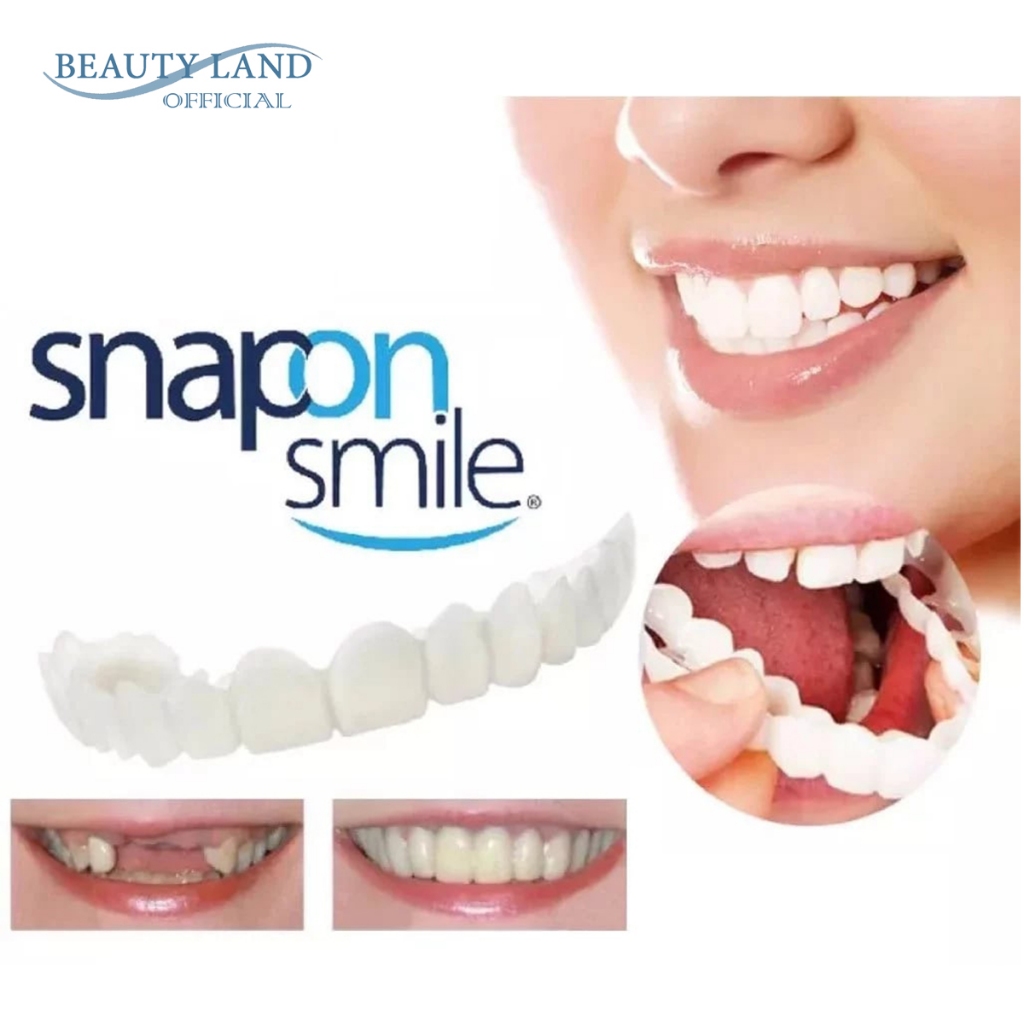 Jual Snap On Smile Gigi Palsu Tahan Lama Dan Fleksibel Original 100% ...