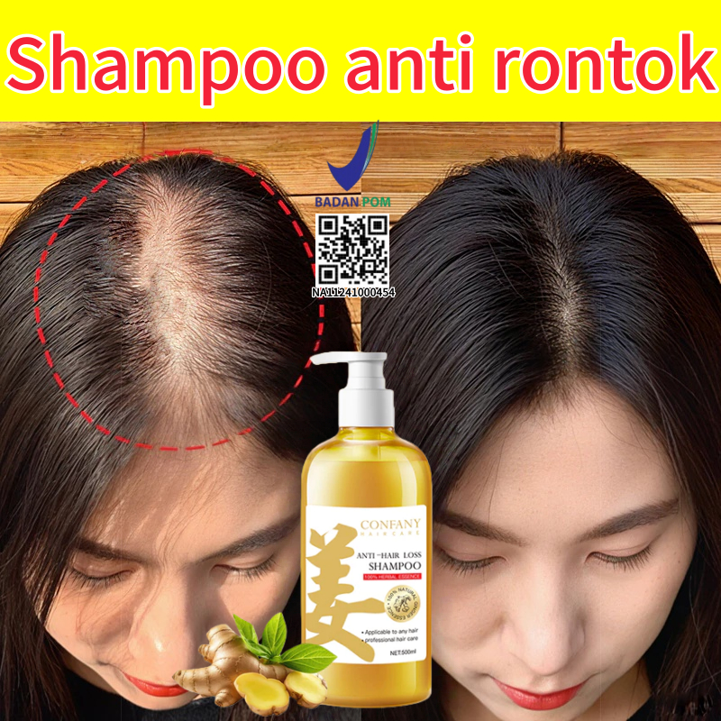 Jual Shampoo rambut rontok Shampoo penumbuh rambut cepat Sampo ...