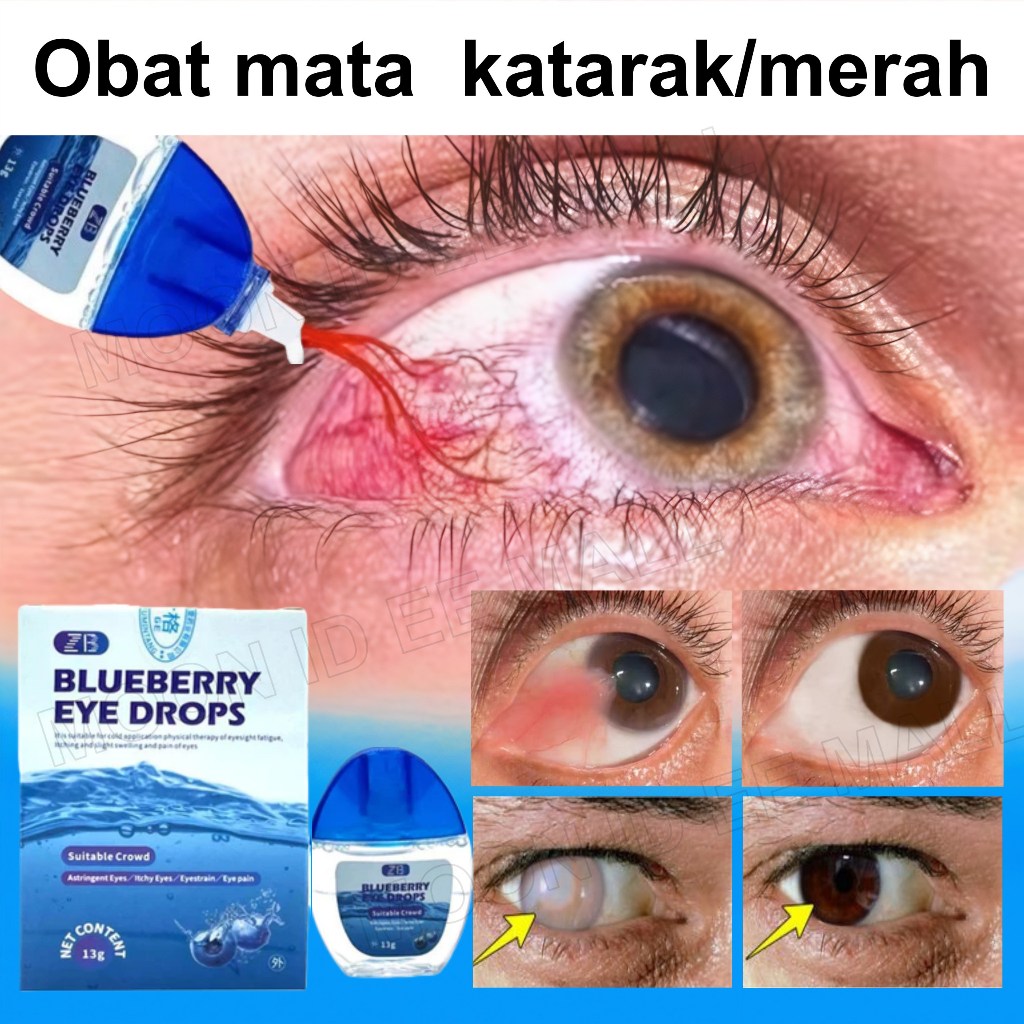 Jual Obat mata katarak Blueberry Eye drop Obat mata merah Pengobatan ...