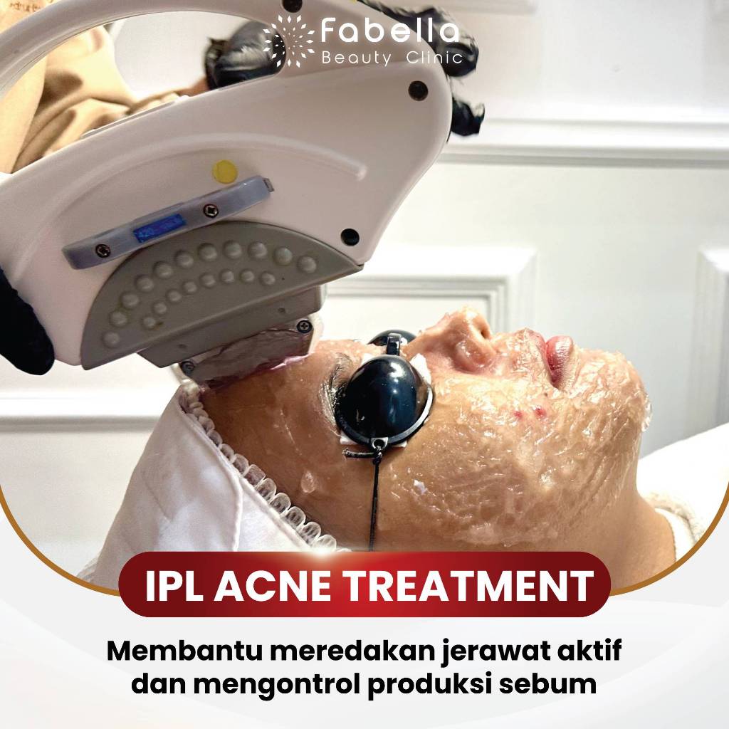 Jual IPL Acne Terlengkap & Harga Terbaru Mei 2026 | Shopee Indonesia