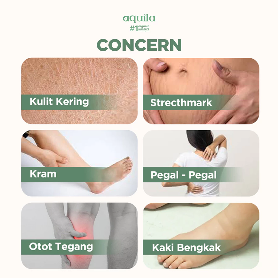 Cara mengatasi stretch mark dan wajah kusam saat hamil trimester 2