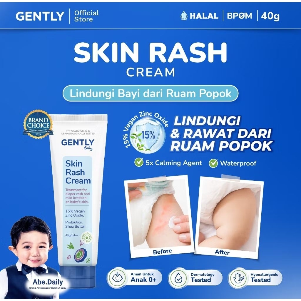Jual GENTLY Baby Rash Cream 40gr - Krim Ruam Popok Pada Bayi | Shopee ...