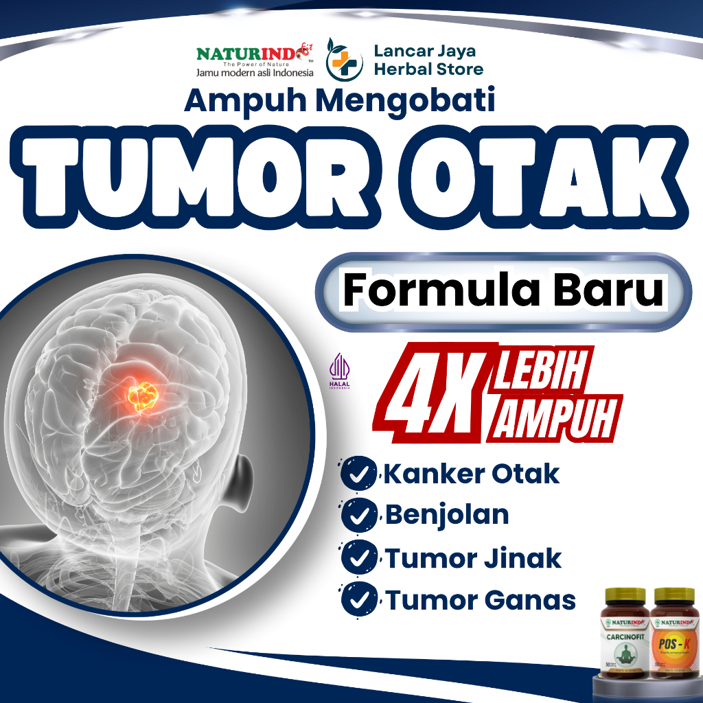 Obat Kanker Tumor Otak Benjolan Hipofisis Herbal Alami