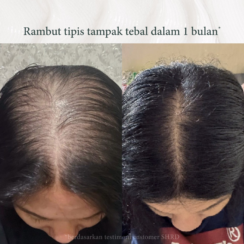 Jual SH-RD | Red Ginseng | Hair Fall Shampoo | Shampoo Rambut Rontok ...