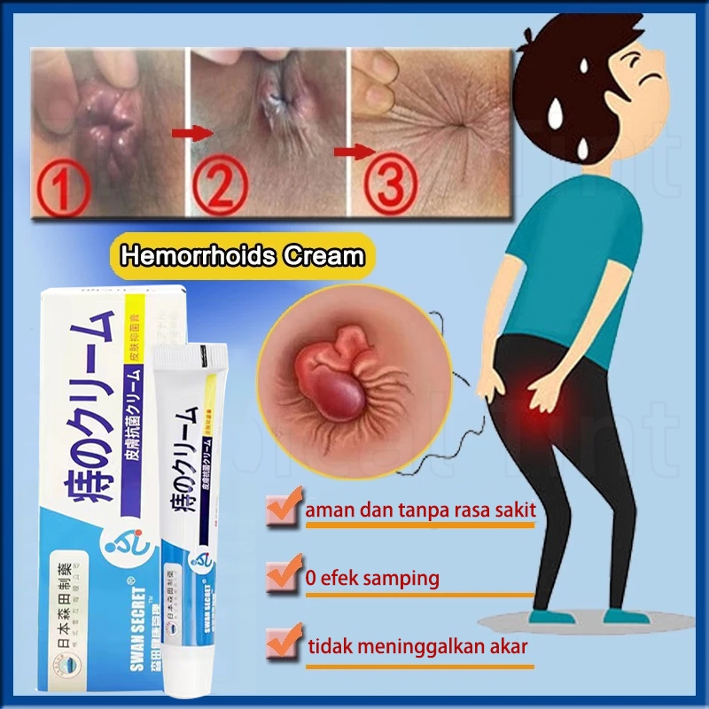 Jepang Salep ambeien paling ampuh 20g Herbal Ampuh Wasir Salep Obat Wasir Ambeien Paling Ampuh Aman Menghilangkan Benjolan Wasir Internal Dan Eksternal mengobati wasir untuk