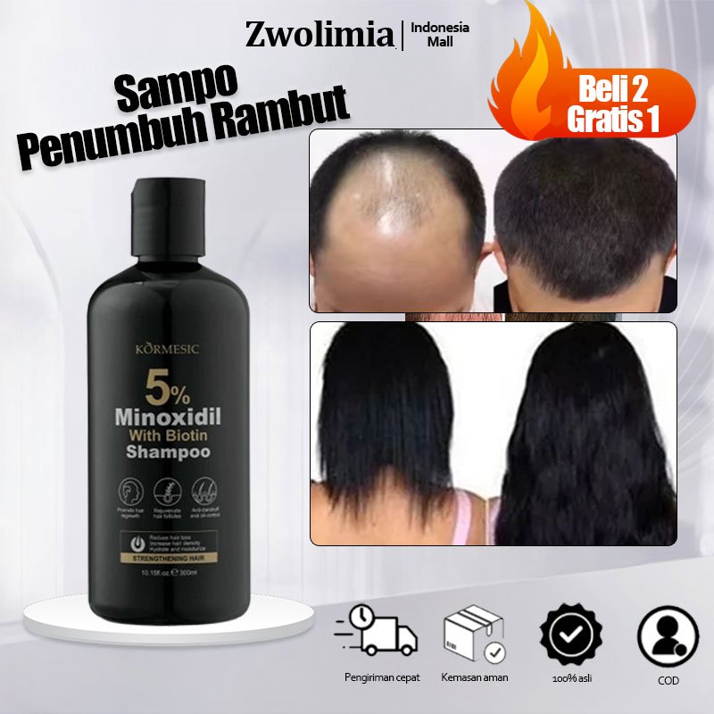 Jual Sampo Penebal Rambut Terlengkap & Harga Terbaru Mei 2026 | Shopee ...