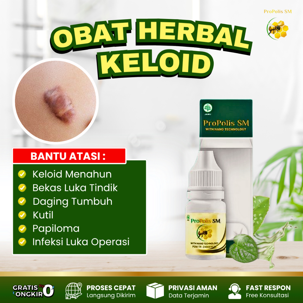 Jual Obat Keloid, Obat Daging Tumbuh, Obat Keloid Injeksi Menahun ...