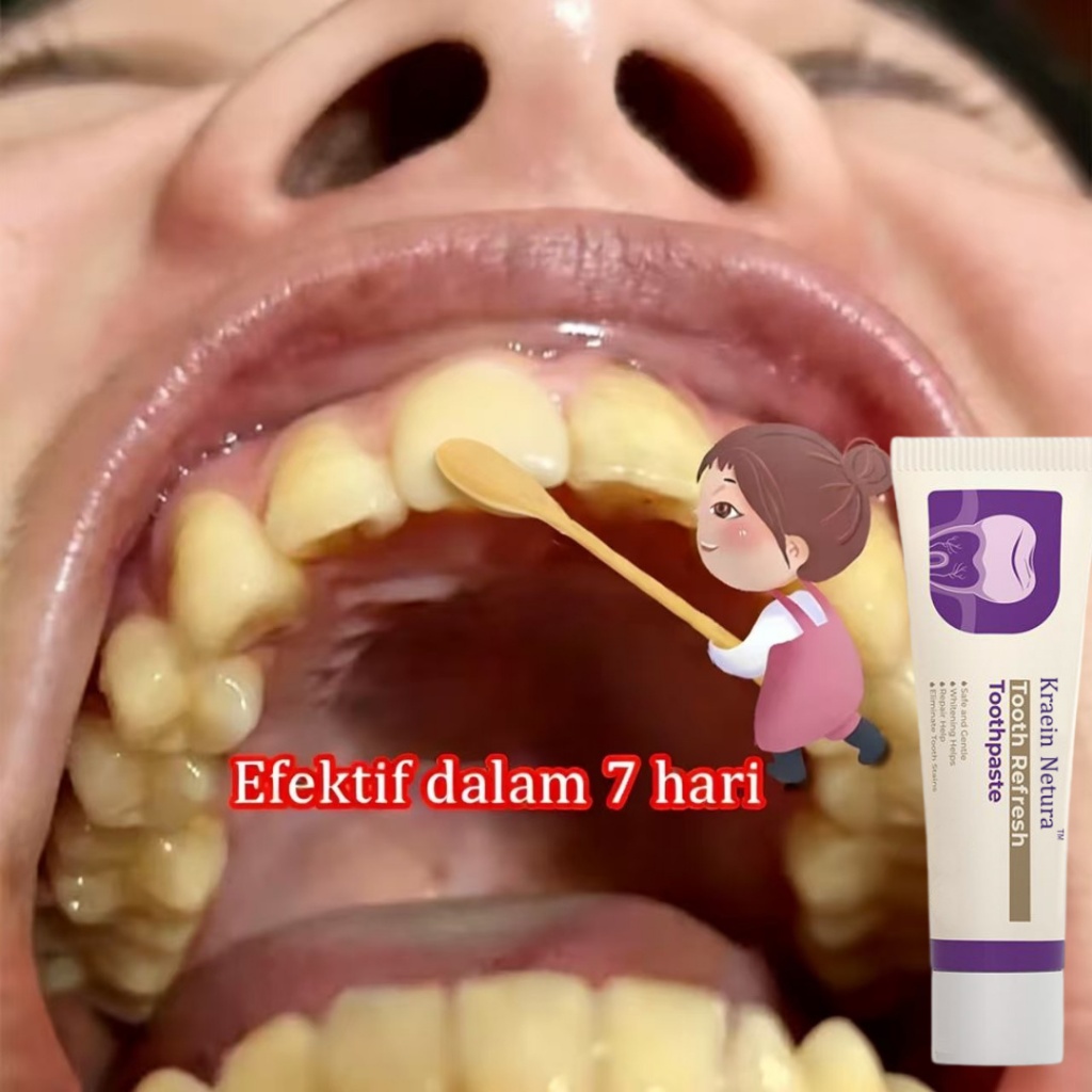 Jual Tooth Refresh Toothpaste Bantu Perbaiki Redakan Masalah Akibat ...
