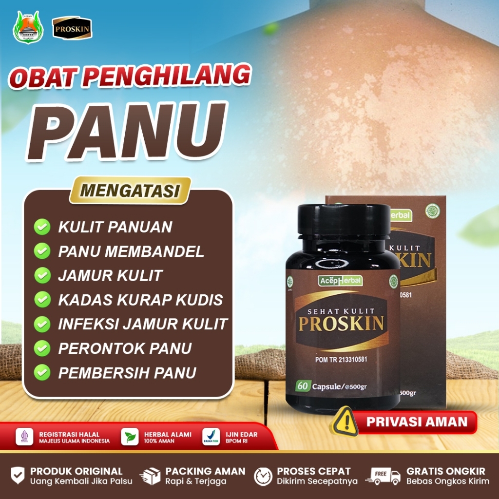 Jual Obat Perontok Panu Jamur Kulit Kadas Kurap Kudis Panuan Kulit ...