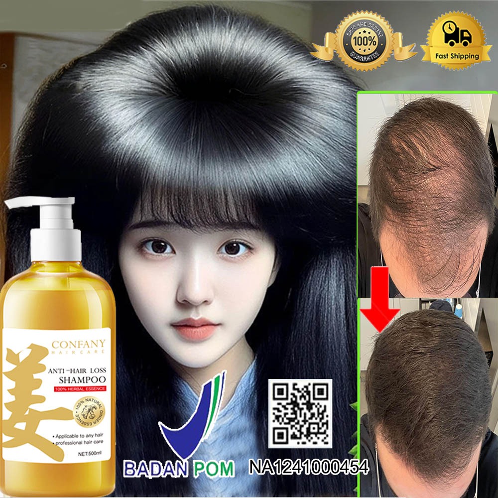 Jual BPOM Shampoo Penumbuh Rambut Cepat Sampo Anti rambut rontok Ginger ...