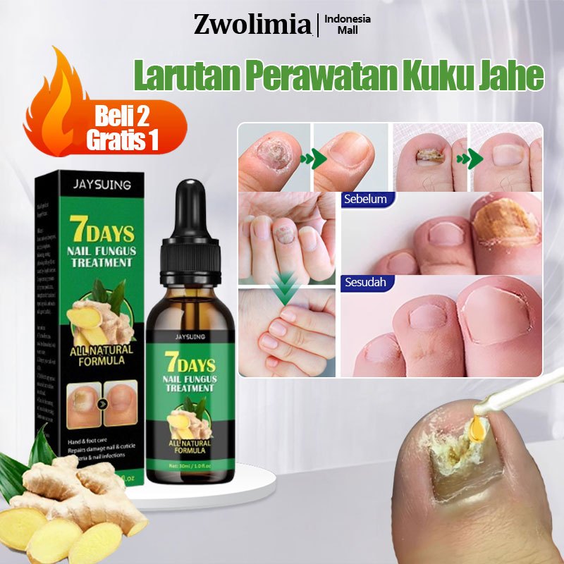 Jual Zwolimia Oba Jamur Kuku Kaki Original Serum Kuku Obt Kuku Jamur
