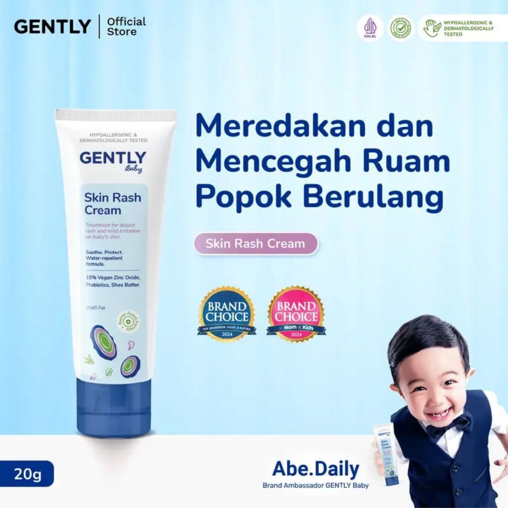 Jual GENTLY BABY RASH CREAM | CREAM PEREDA RUAM POPOK | Shopee Indonesia