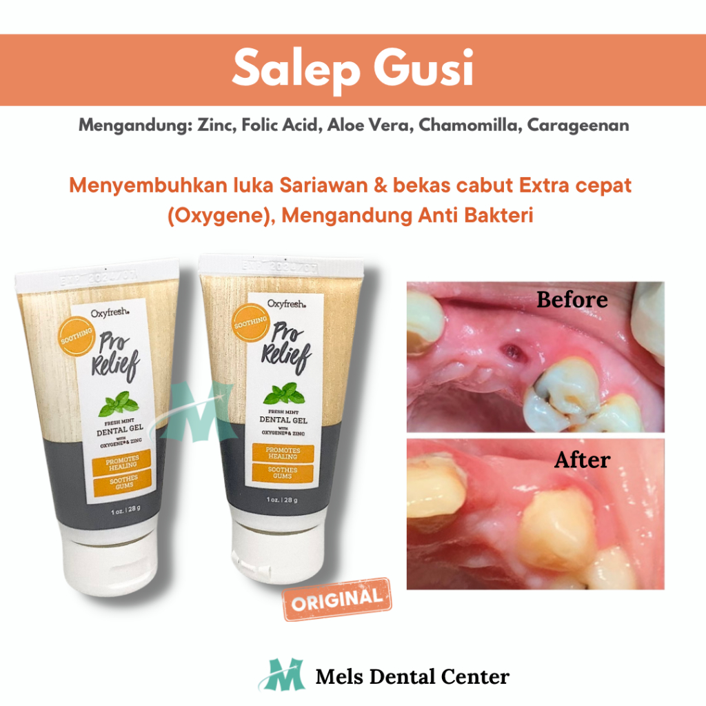 Jual Oxyfresh Dental Gel Terlengkap & Harga Terbaru Juli 2026 | Shopee ...