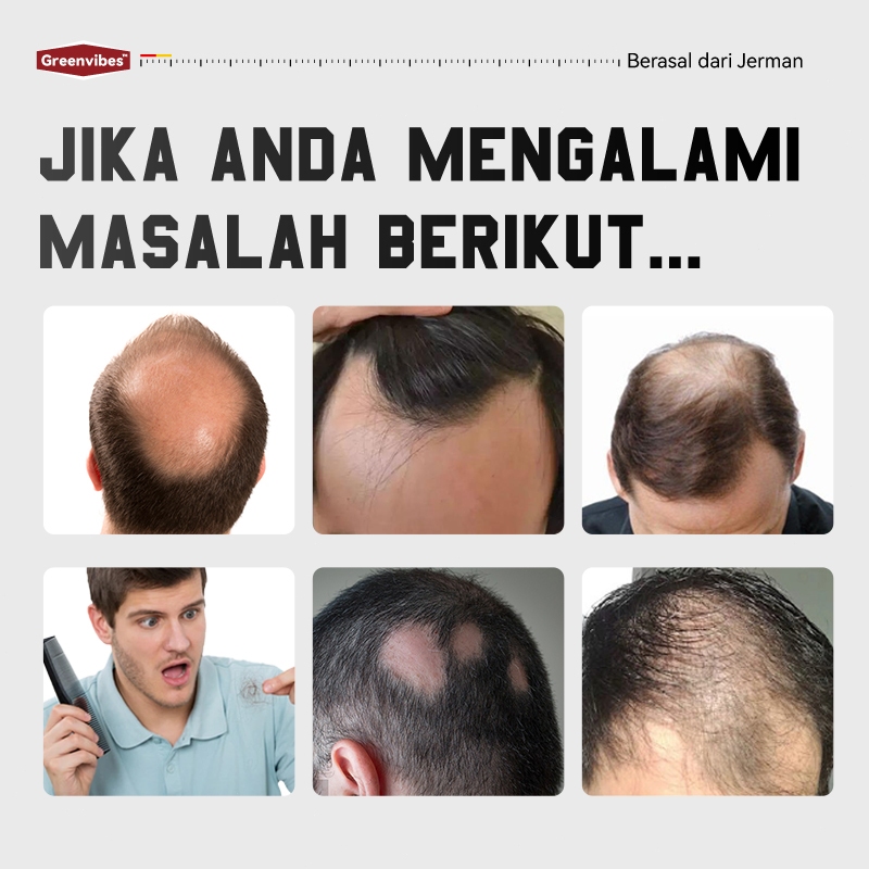 Masalah Rambut