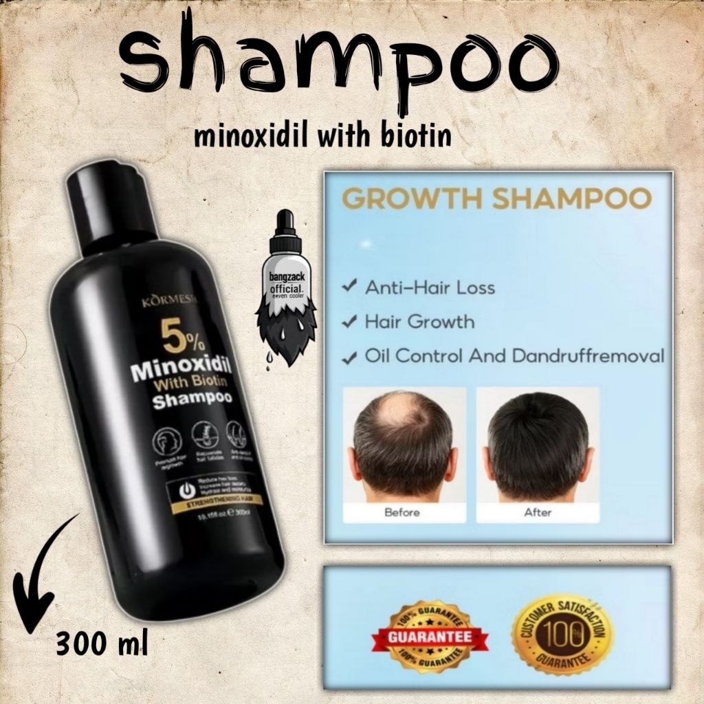 Jual shampoo minoxidil with biotin 300 ml | Shopee Indonesia
