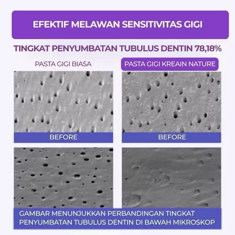 Tooth Refresh 5