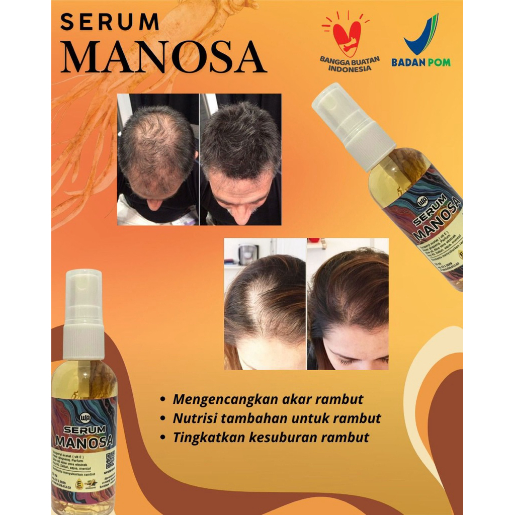 Jual Hair Serum Manosa 50ml BPOM Penumbuh Rambut & Penguat Akar Rambut ...