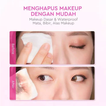 UMARA GLAD2GLOW Brightening Micellar Water 230ml L Rich In Niacinamide Skintint Glow Booster