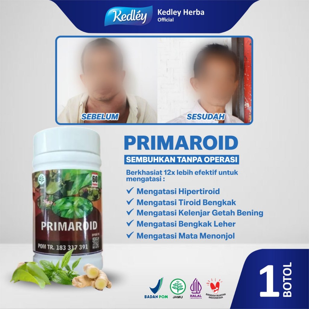 Jual Obat Herbal Hipertiroid, Hipotiroid, Gondongan, Benjolan Dileher ...