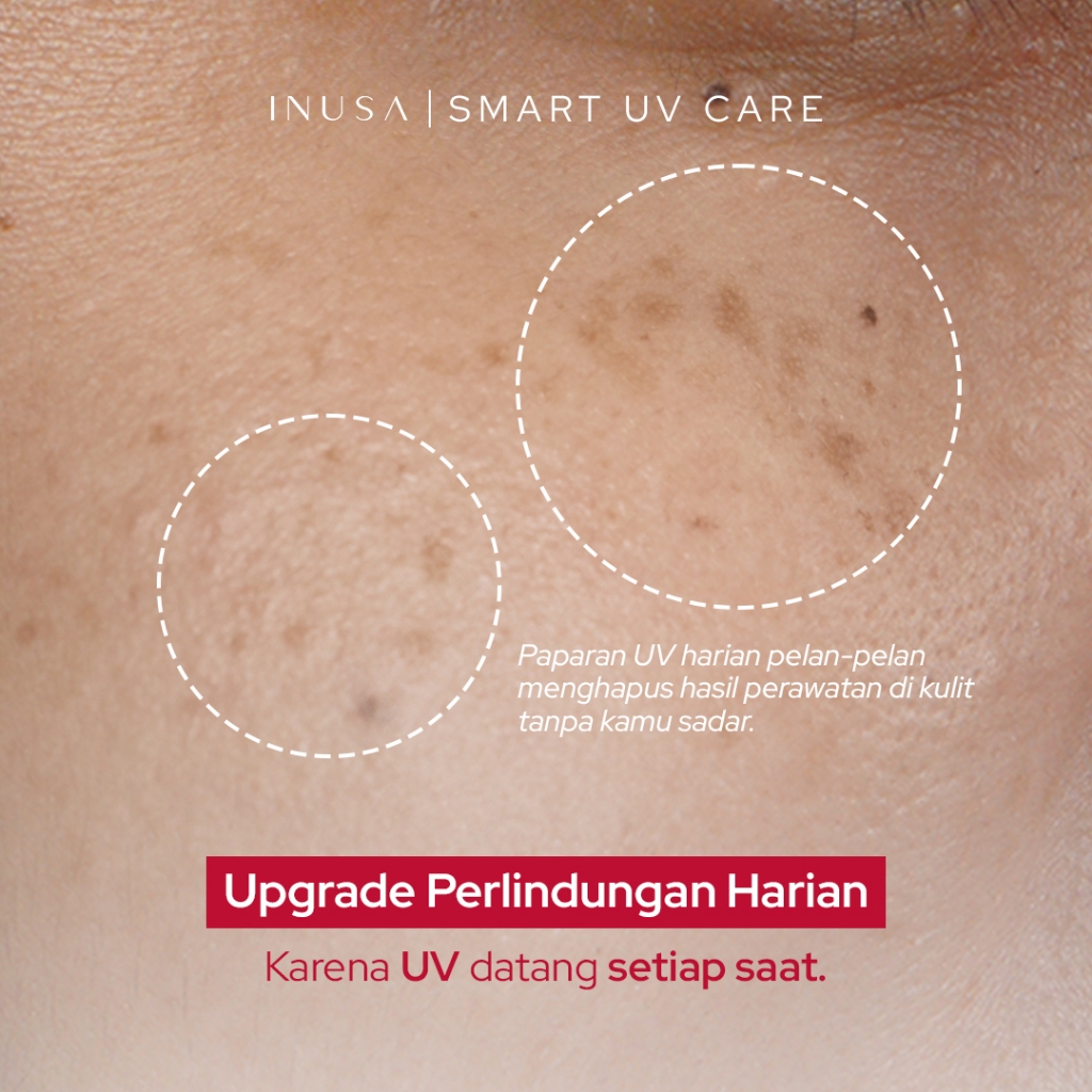 Jual [NEW] Inusa UV Perfect Sunscreen 3% Tranexamic Acid SPF 50 ...