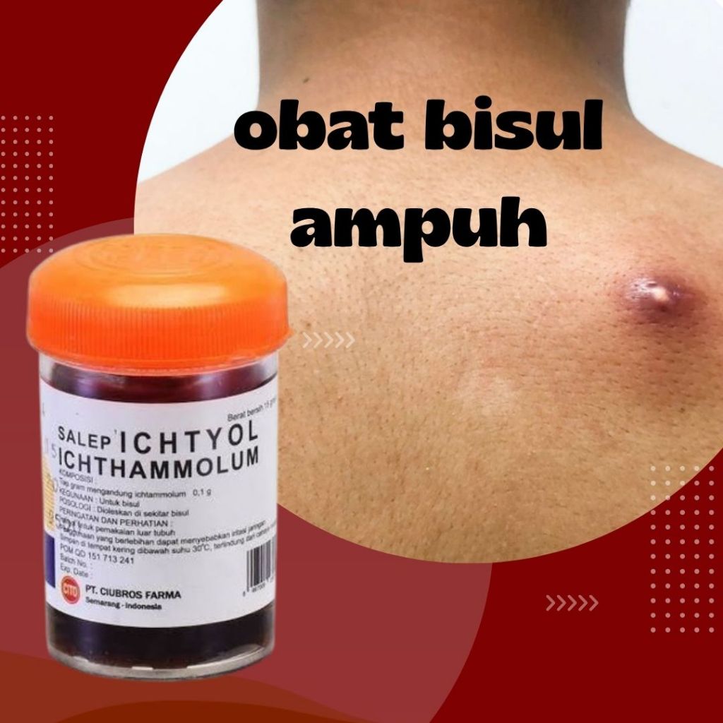 Jual Salep Bisul Terlengkap & Harga Terbaru April 2026 | Shopee Indonesia