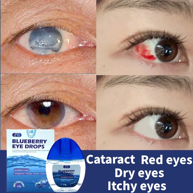 Jual Obat mata katarak Blueberry Eye drop Obat mata merah Pengobatan ...