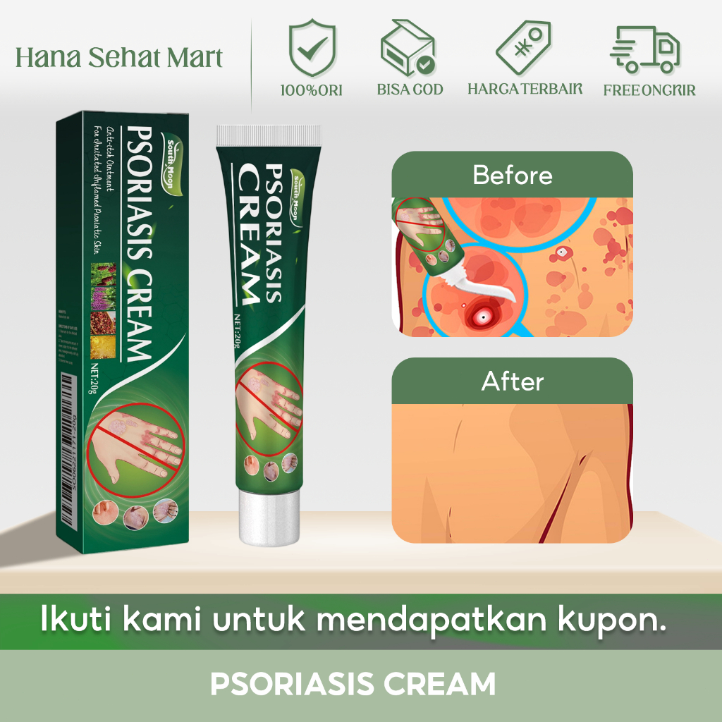 Jual South Moon Psoriasis Cream 20g Salep Anti Gatal Paling Ampuh ...