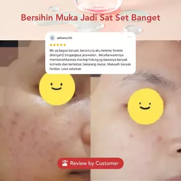 Forebie Clean The Skin Micellar Water Infused With Blue Tansy Pembersih Wajah Lembut Menenangkan