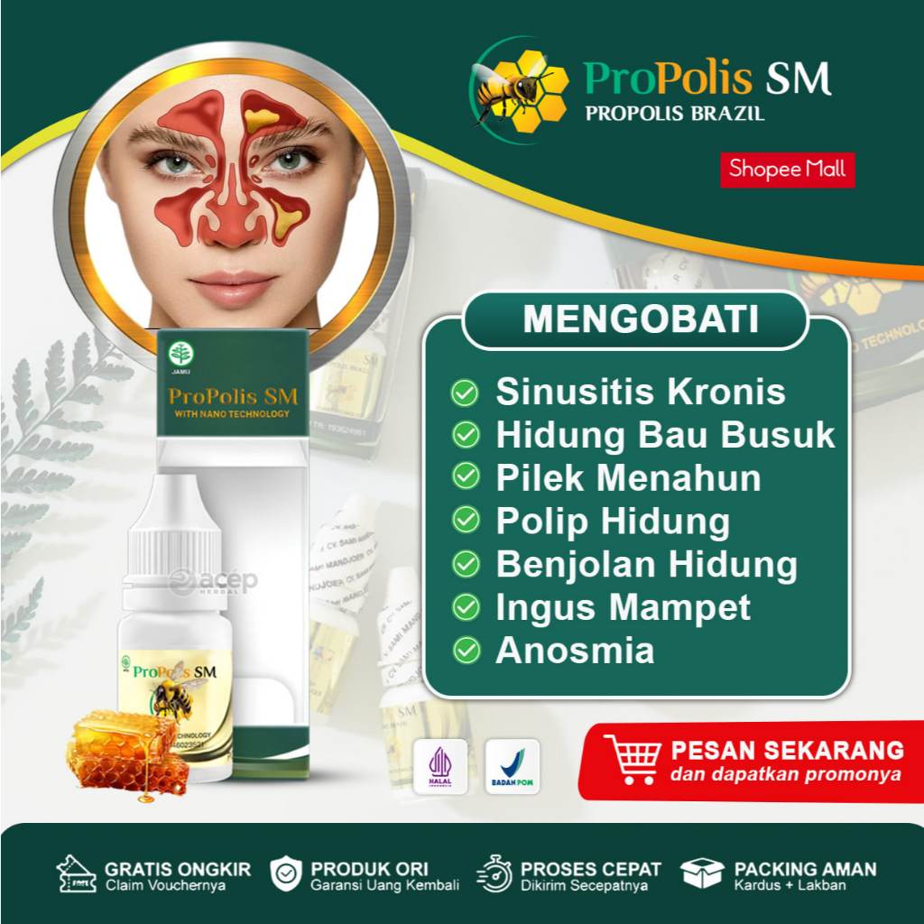 Jual Obat Sinusitis, Herbal Sinusitis, Radang Sinus, Pilek Menahun ...