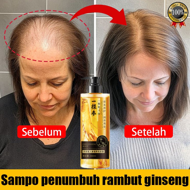 Jual Shampoo Penumbuh Rambut Cepat Ginseng Shampoo Anti Rontok Rambut ...