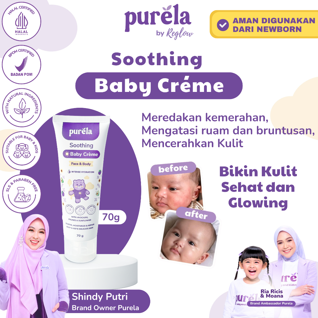 Jual PURELA Soothing Baby Creme 70gr - Krim Bayi dan Anak Untuk ...