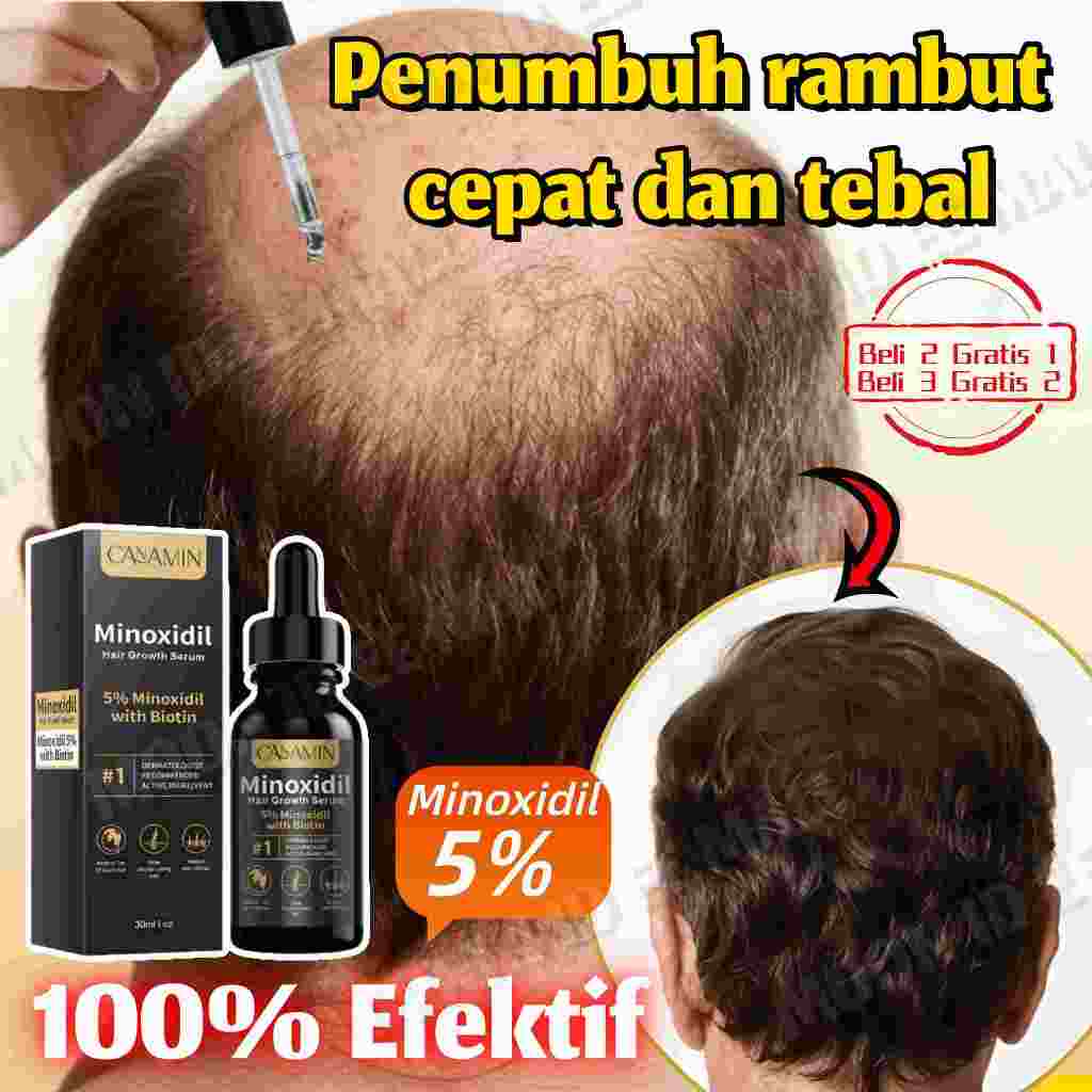 Jual Serum Penumbuh Rambut Botak Minoxidil 5% Hair Growth Serum Minyak ...