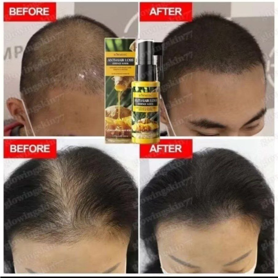 Jual Capillus Ginger essence / visible hair Growth approved serum ...