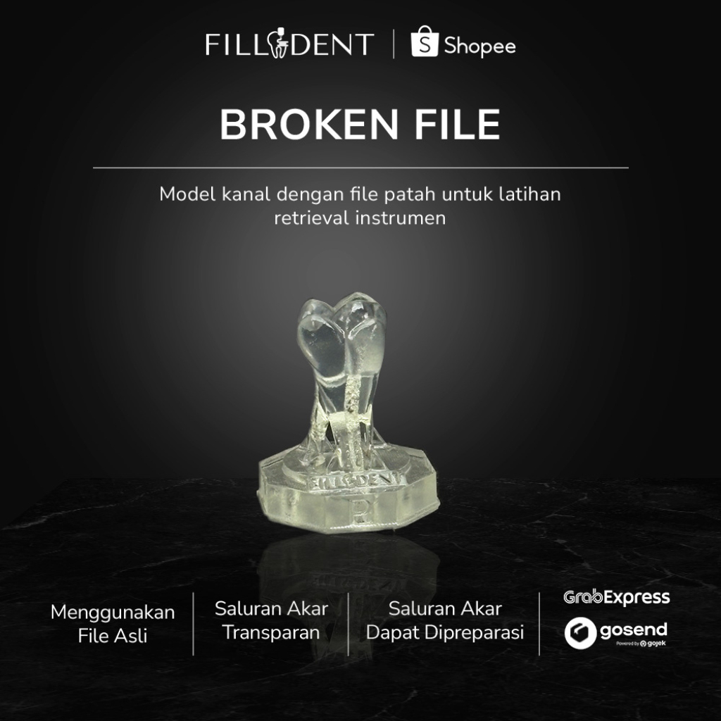 Jual Filladent Broken File Endodontic Model | Latihan Retrieval ...