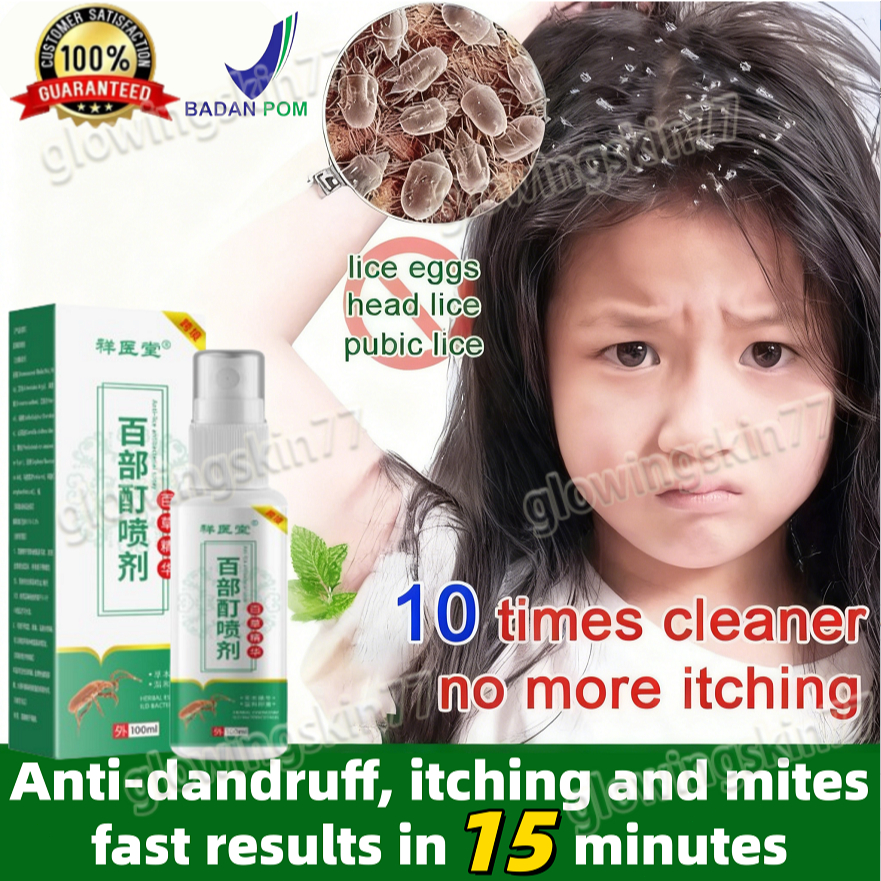 Jual [COD]100ml Obat Kutu Rambut Anti Lice semprot ( semprot Kutu ...