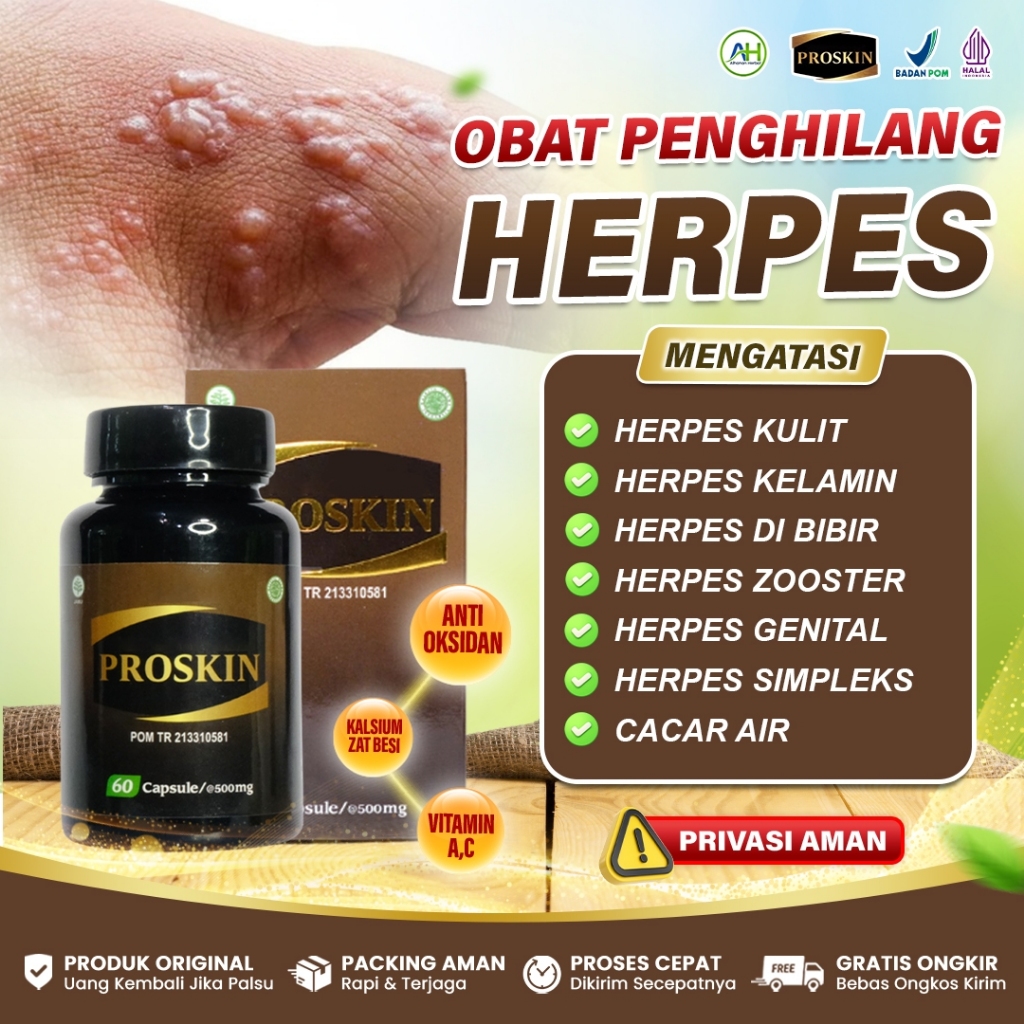 Obat Herpes Kulit - Obat Herpes Herbal - Obat Herpes - Obat Penghilang Herpes - Obat Herpes Kelamin - Obat Herpes Zooster - Obat Herpes Di Bibir - Obat Salep Herpes - Obat Herpes Anak Dewasa - Obat Herpes Genital - Sehat Kulit Proskin Original 60 Kapsul