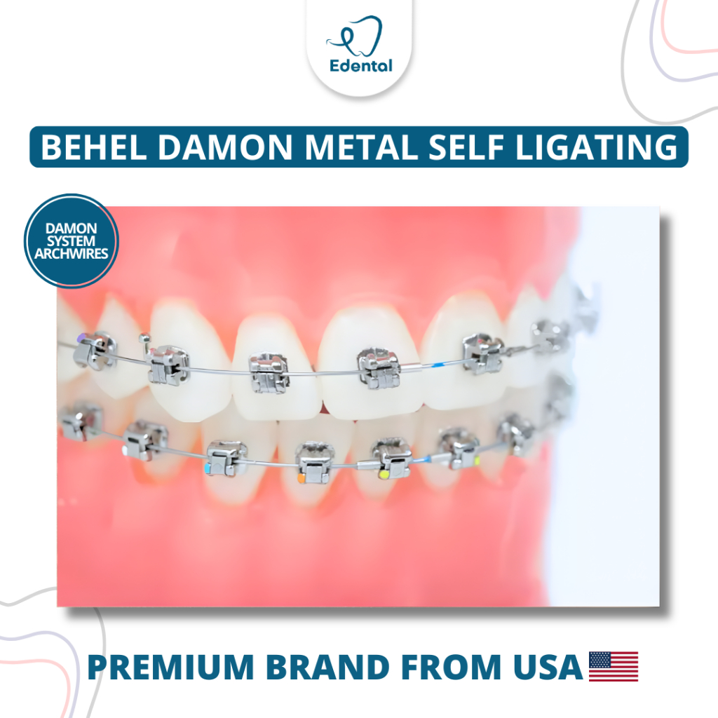 Jual Pasang Behel Damon Metal Self Ligating Premium Edental - Kawat ...